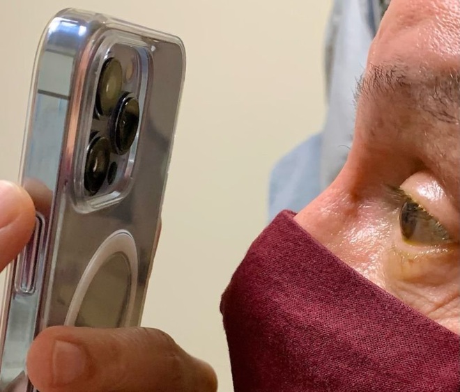 Dùng iPhone 13 Pro Max để khám mắt cho bệnh nhân - 1